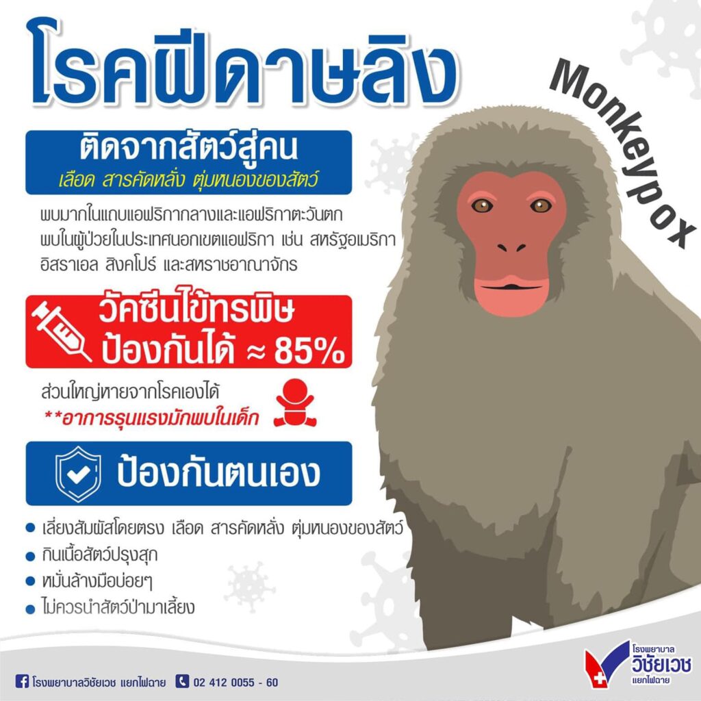 โรคฝีดาษลิง