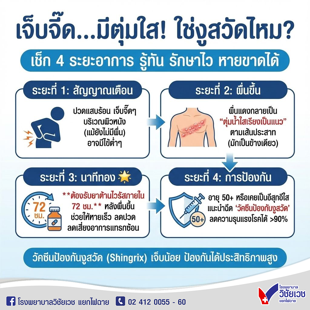 เช็ก 4 ระยะอาการ โรคงูสวัด รู้ทัน รักษาไว หายขาดได้