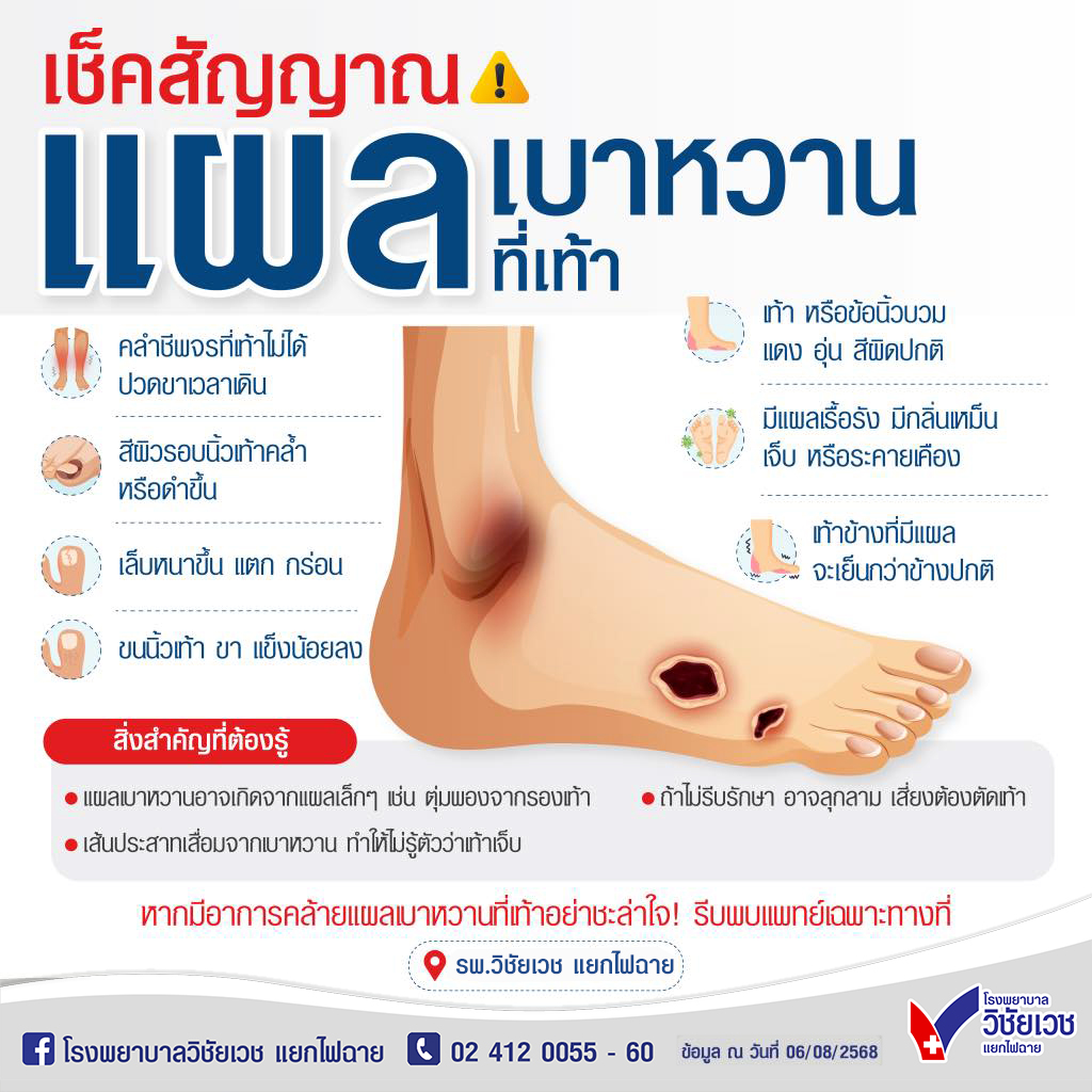 เช็คสัญญาณ แผลเบาหวานที่เท้า