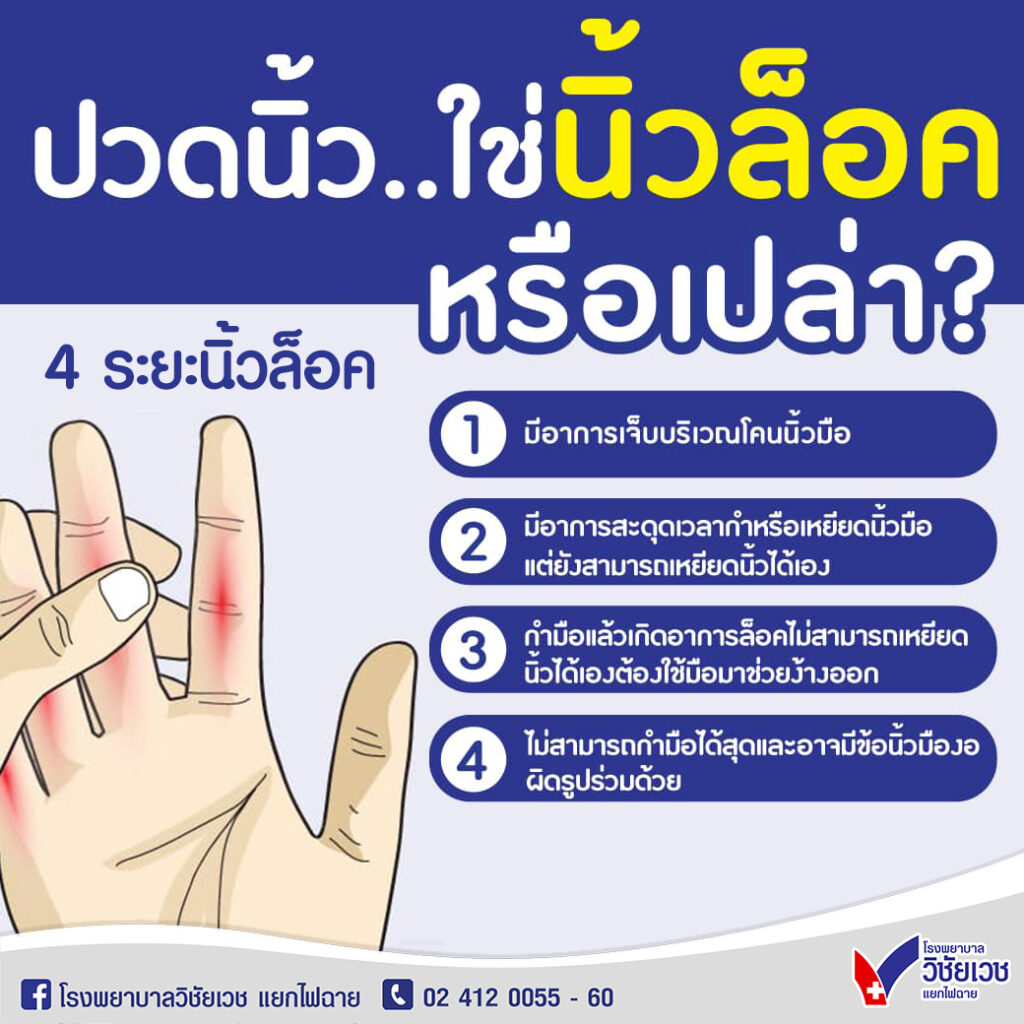 ปวดนิ้ว… ใช่นิ้วล็อคหรือเปล่า?