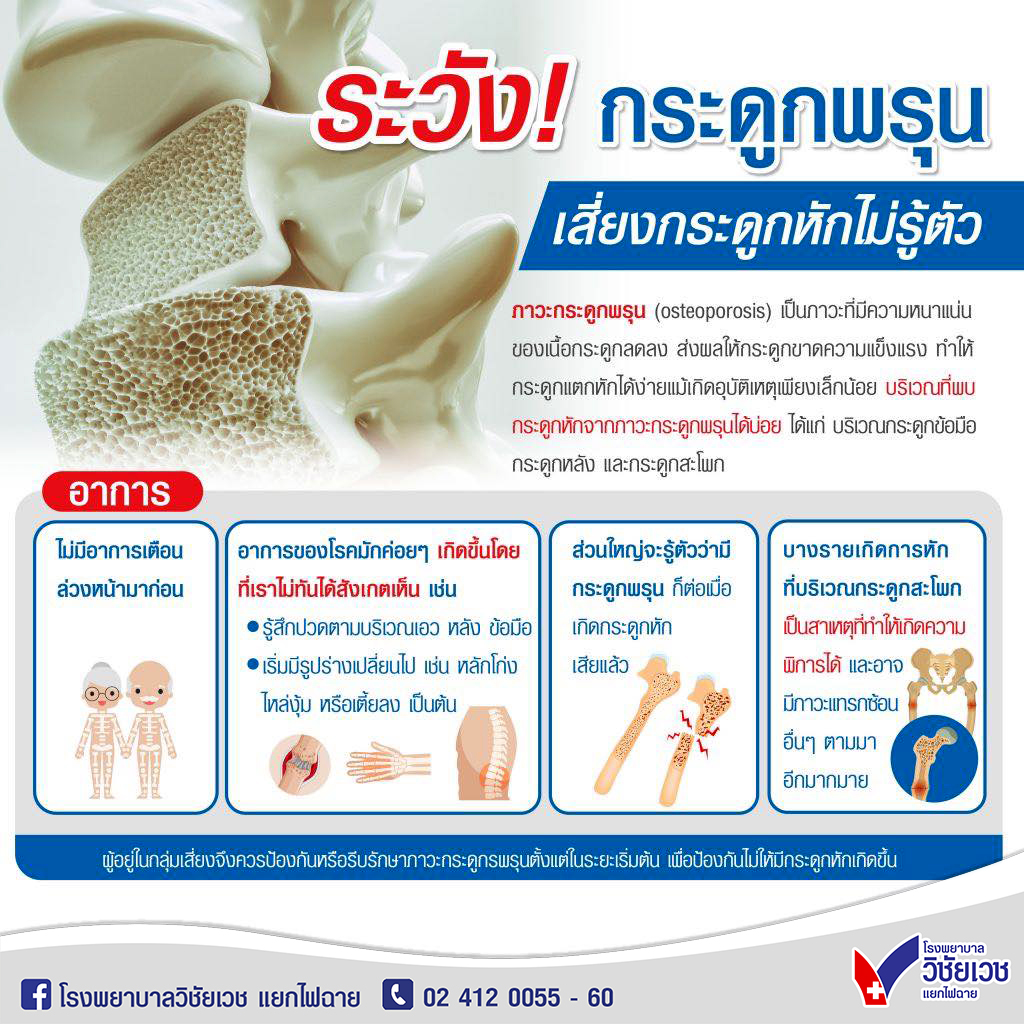 ระวัง! กระดูกพรุน อาจกระดูกหักโดยไม่รู้ตัว