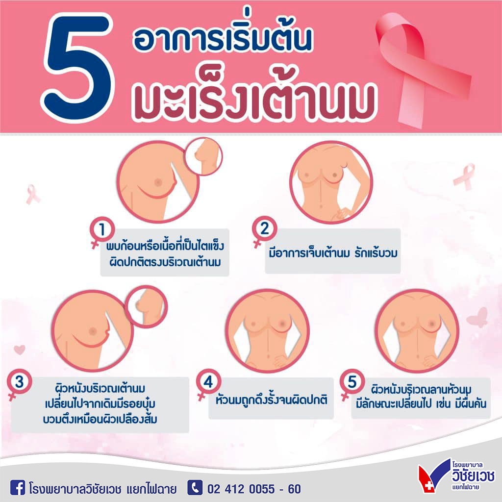 5 อาการเริ่มต้น มะเร็งเต้านม
